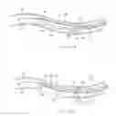 Fig. 14 - Apparatus and methods for treating obstructions within body lumens