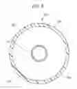 Fig. 06 - BALLOON CATHETER