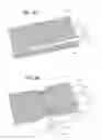 Fig. 07 - Textile balloon catheters