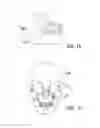 Fig. 10 - BONE IMPLANT AND SYSTEMS THAT CONTROLLABLY RELEASES SILVER