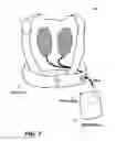 Fig. 07 - Reliable readiness indication for a wearable defibrillator