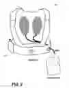 Fig. 09 - Reliable readiness indication for a wearable defibrillator
