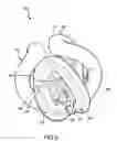 Fig. 08 - SEGMENTED BALL WITH LIGHTED ELEMENTS