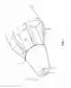 Fig. 02 - Fortified plastic disposable torque devices