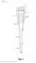 Fig. 02 - HANDLED RATCHETING TOOL WITH A FLIP OUT HANDLE