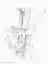 Fig. 02 - Stack mold support structure for an injection molding machine