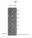 Fig. 08 - Anti-microbial activity of synthetic peptides