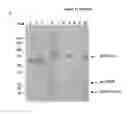 Fig. 16 - MEANS AND METHODS FOR TREATING CMV