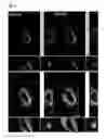 Fig. 12 - BLOOD BRAIN BARRIER SHUTTLE