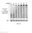 Fig. 07 - Method of extending DNA with telomerase and method of measuring telomerase activity