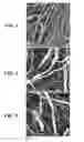 Fig. 06 - Hybrid non-woven web and an apparatus and method for forming said web