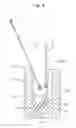 Fig. 09 - Support wire implanting anchor