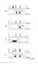 Fig. 07 - Method to determine the injection pattern in the intake stroke of the combustion cycle of the cylinders of a direct-injection internal combustion engine
