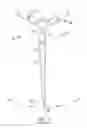 Fig. 02 - SOILING SHIELD FOR WIND TURBINE BLADE