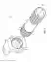 Fig. 02 - SPLINE PRESS FIT ORIENTATION LEAD IN