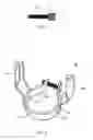 Fig. 05 - LIGHT FIXTURE HARP ADAPTER