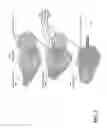 Fig. 02 - Method and system of assessing or analyzing muscle characteristics including strength and tenderness using ultrasound