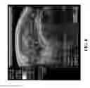 Fig. 07 - Method and system of assessing or analyzing muscle characteristics including strength and tenderness using ultrasound