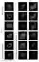 Fig. 11 - SATB1:  A DETERMINANT OF MORPHOGENESIS AND TUMOR METASTATIS