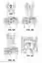 Fig. 09 - Methods for Identifying Compounds That Modulate Ion Channel Activity of a Kir Channel