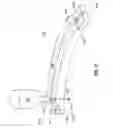 Fig. 15 - Dual retention apparatus