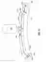 Fig. 16 - Dual retention apparatus