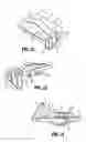 Fig. 08 - AUTHENTICATION AND INFORMATION SYSTEM FOR REUSABLE SURGICAL INSTRUMENTS