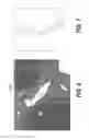 Fig. 07 - Systems and methods for determining blood flow characteristics using flow ratio