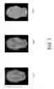 Fig. 02 - Head-pose invariant recognition of facial attributes