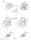 Fig. 02 - Distribution of infusion pumps