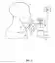 Fig. 02 - Systems and methods for real-time tumor tracking