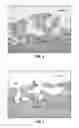 Fig. 10 - METHOD FOR QUANTIFYING COLLAGEN FIBER ALIGNMENT IN PERIPROSTHETIC TISSUE
