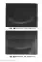 Fig. 16 - METHOD FOR QUANTIFYING COLLAGEN FIBER ALIGNMENT IN PERIPROSTHETIC TISSUE