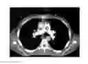Fig. 01 - Methods and apparatus for individually optimizing uniform contrast enhancements in computed tomography imaging