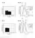 Fig. 07 - Methods and apparatus for individually optimizing uniform contrast enhancements in computed tomography imaging