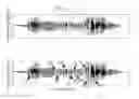 Fig. 01 - Method and apparatus for detecting voice signal