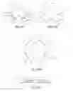 Fig. 06 - Attachment device