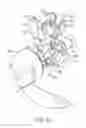 Fig. 09 - Tissue resecting system