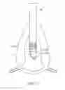 Fig. 17 - Tissue resecting system