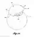 Fig. 07 - FLEXIBLE CONTACT LENS