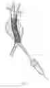 Fig. 08 - Surgical Fastener Assembly for Attaching a Prosthesis