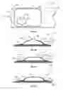 Fig. 07 - METHODS, SYSTEMS, AND DEVICES FOR APPLYING TARGET FORCE TO A RADIAL ACCESS PUNCTURE SITE