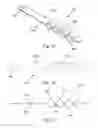 Fig. 08 - Method of performing sacroiliac fusion