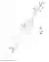 Fig. 09 - Apparatus and method for treating disorders of the ear, nose and throat