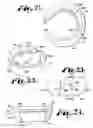 Fig. 07 - POLYAXIAL BONE ANCHOR HAVING AN OPEN RETAINER WITH CONICAL, CYLINDRICAL OR CURVATE CAPTURE