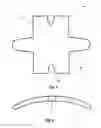 Fig. 02 - Spinal graft