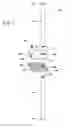 Fig. 02 - Temporary fracture stabilization device