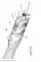 Fig. 08 - Composite material bone implant