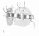 Fig. 04 - Flexible plate fixation of bone fractures