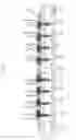 Fig. 07 - Flexible plate fixation of bone fractures